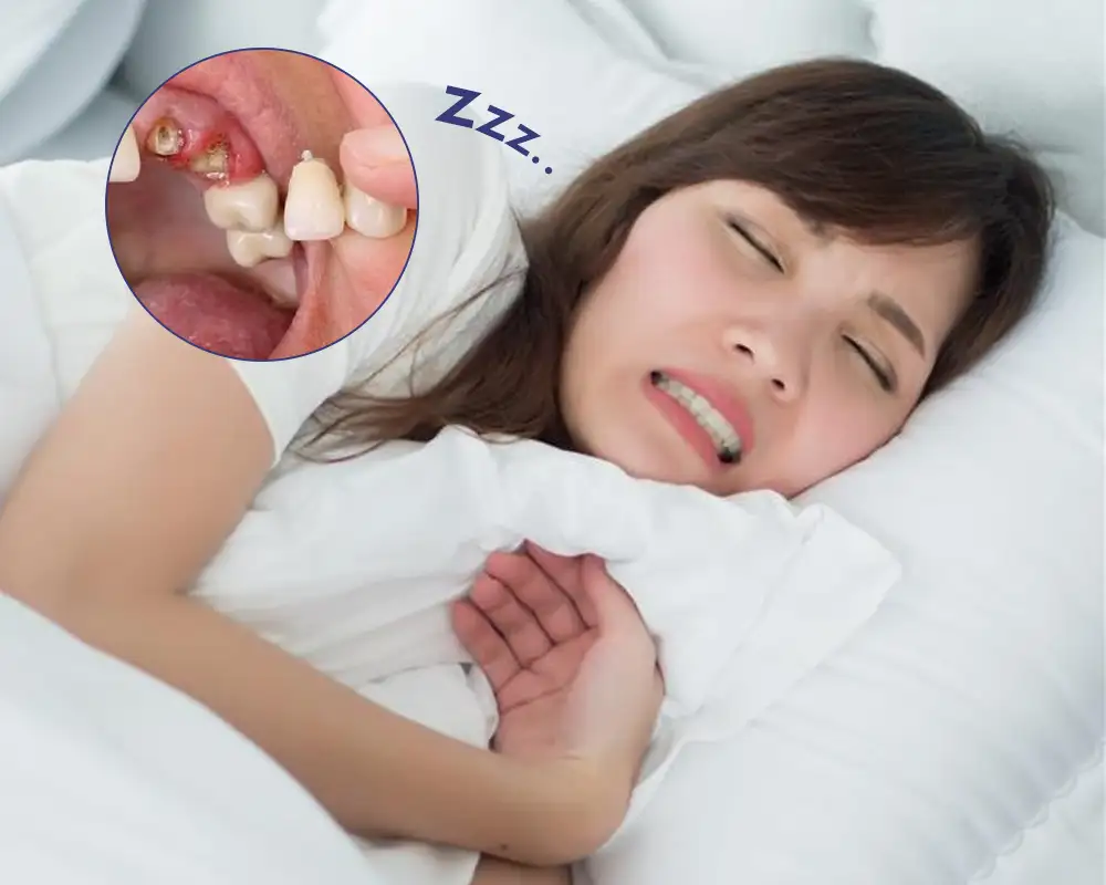 nằm mơ thấy bị gãy răng