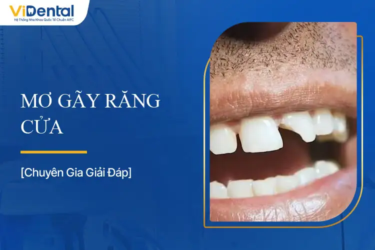 {mơ thấy rụng răng cửa}