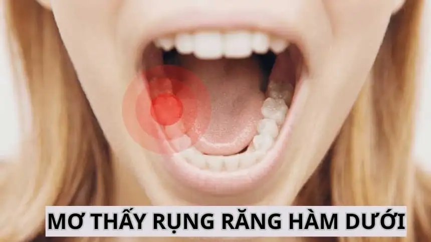 giấc mơ rụng răng