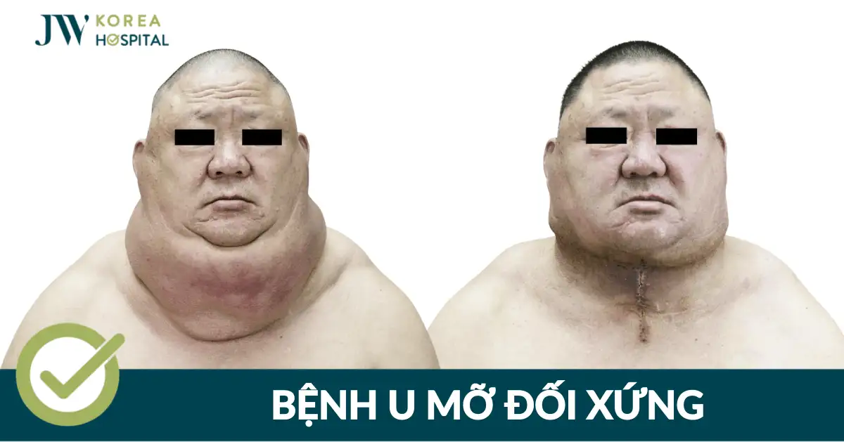 {mơ rụng răng hàm}