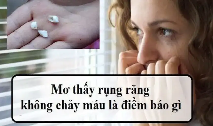 giải mã giấc mơ thấy rụng răng không chảy máu