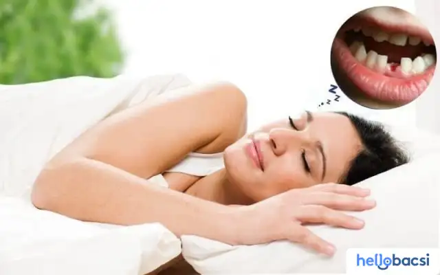 Nằm Mơ Mình Bị Rụng Răng: Giải Mã Khoa Học & Tâm Linh Toàn Diện Nhất