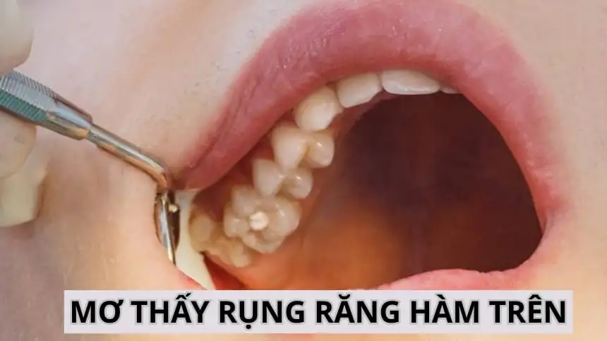 Giải Mã Giấc Mơ Thấy Răng Rụng Không Chảy Máu: Điềm Lành Hay Dữ?