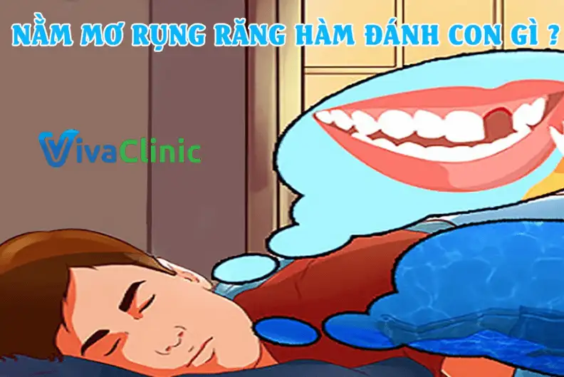 Giải Mã Giấc Mơ Thấy Rụng Răng Hàm Dưới: Điềm Báo và Con Số May Mắn