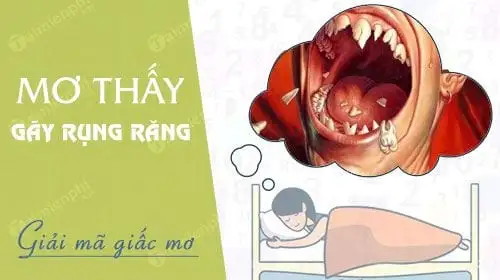 nằm mơ thấy rụng răng không chảy máu