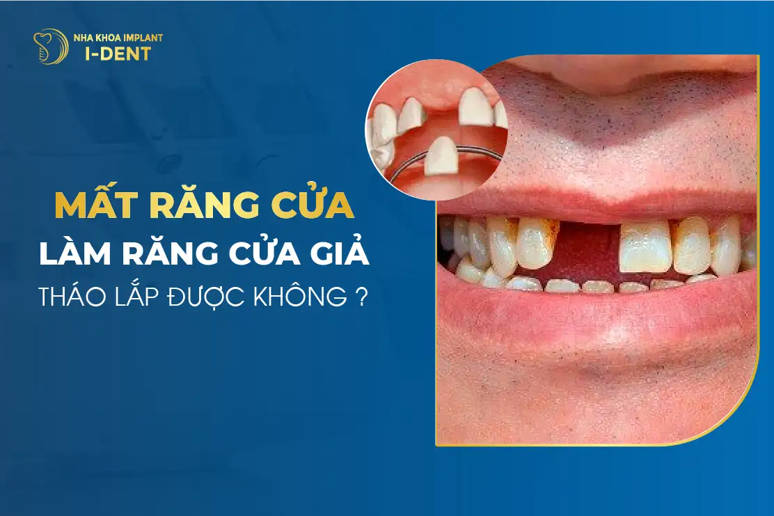 mơ thấy răng cửa rụng