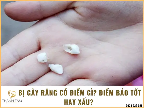 nằm mơ thấy bị gãy răng chảy máu