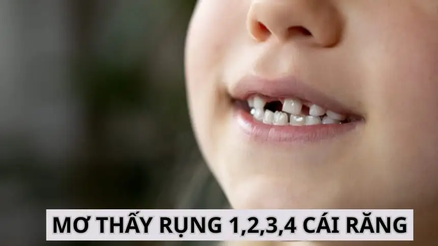 mơ thấy răng mình rụng chảy máu