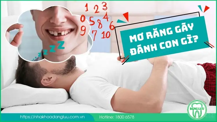 nằm mơ thấy rụng răng hàm dưới đánh con gì