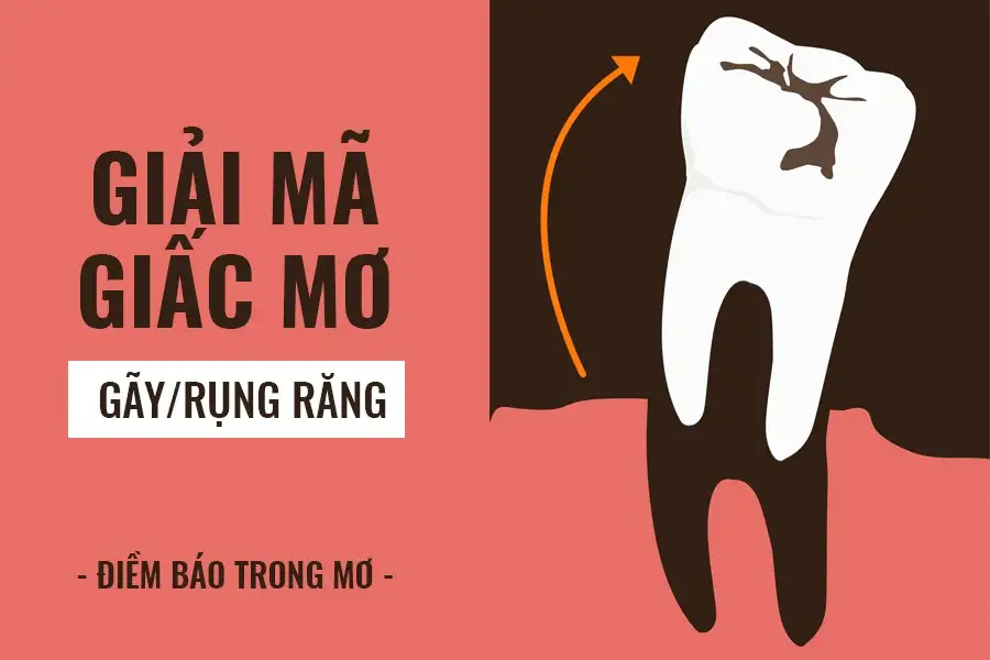mơ mình bị rụng răng