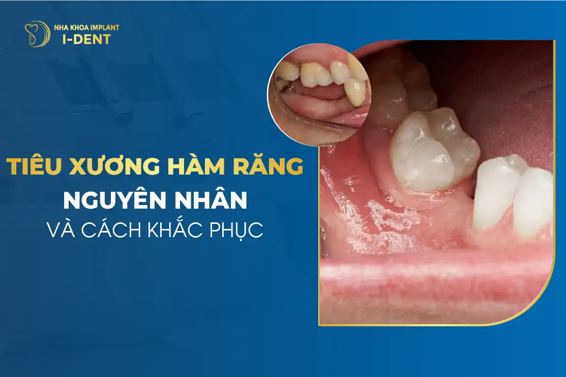 mơ thấy răng lung lay không chảy máu