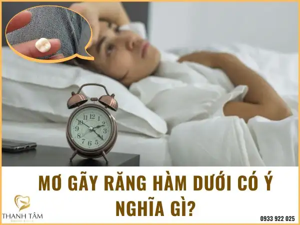 Nằm Mơ Thấy Mình Bị Gãy Răng: Giải Mã Điềm Báo Tốt Hay Xấu Từ Góc Độ Khoa Học và Tâm Linh