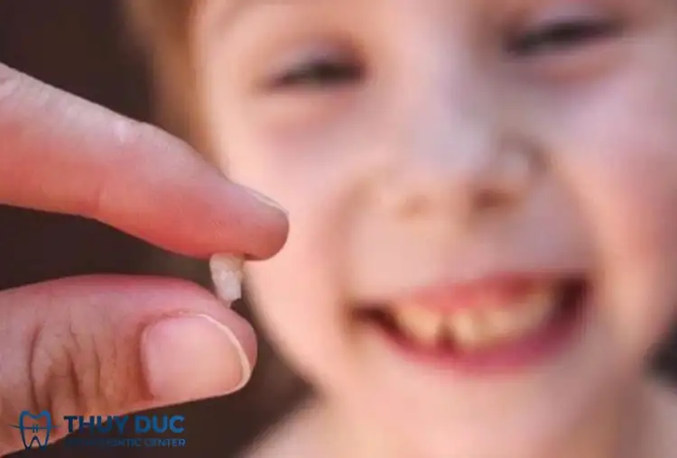 nằm mơ thấy gãy răng hàm dưới