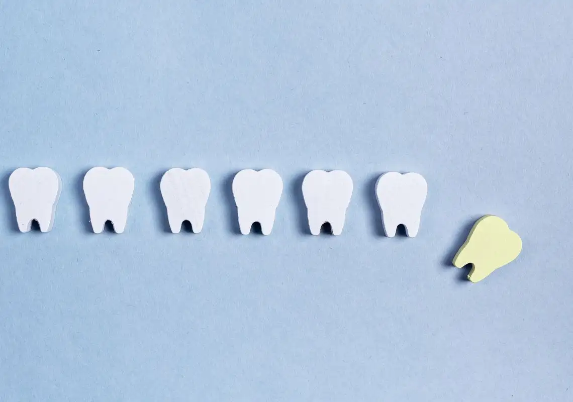 nằm mơ thấy rụng răng hàm dưới có máu