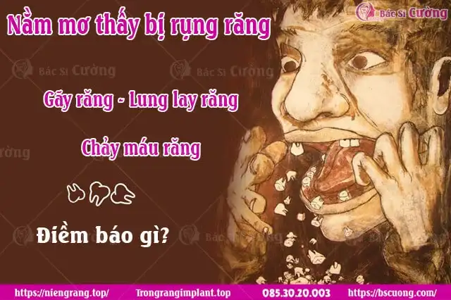giấc mơ rụng răng